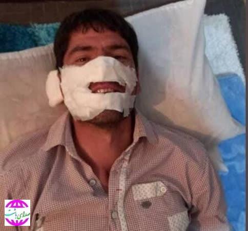 دستور ویژه رئیس سازمان جنگل ها برای اعزام کوهنورد مصدوم در آتش سوزی جنگل‌های باشت